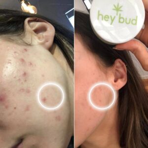 Hey Bud Mushroom Magic - Hey Bud before & After use